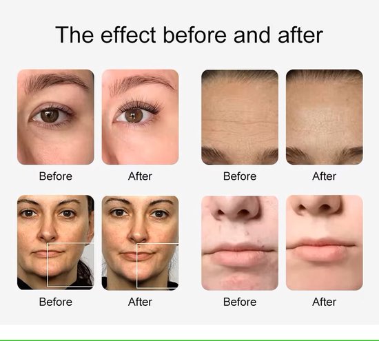 10-in-1 Gezichtsverzorgingsmachine – Beauty Apparaat voor Diepe Reiniging