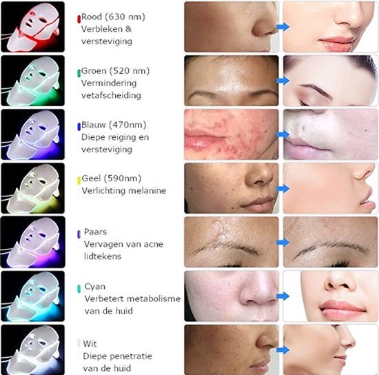 Hydrafacial Machine – Gezichtsverzorgingsapparaat voor Diepe Reiniging